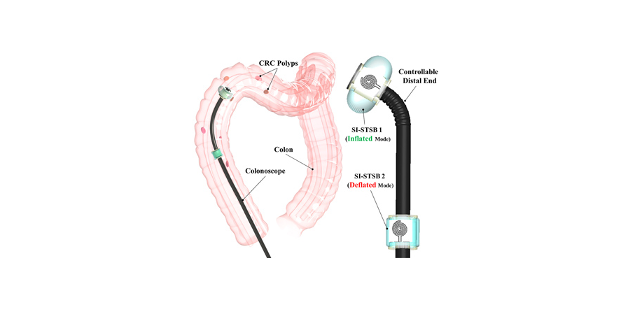 Concept showing inflatable tactile sensing structures integrated with a colonoscope.